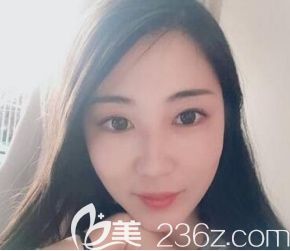 我在遵義韓美做這個(gè)取頰脂墊+面部吸脂手術(shù)是全麻的，感覺(jué)就是睡了個(gè)覺(jué)的工夫。