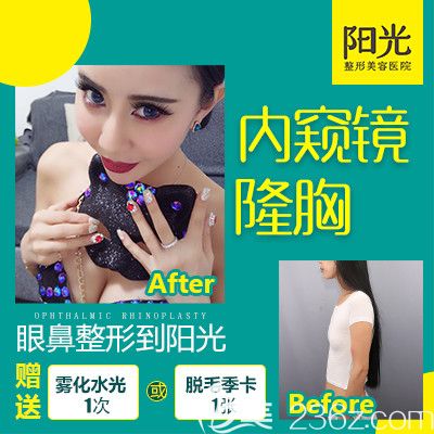 深圳陽光整形醫(yī)院5.1優(yōu)惠活動價格表 李映雨隆胸98000元起,雙眼皮隆鼻項目7.5折