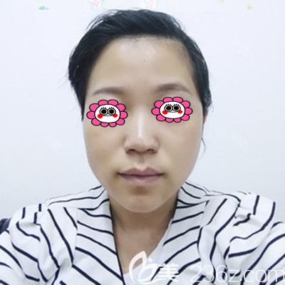 面部<span style= 面部<span style=