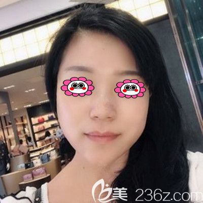 埋線提升第15天<span style= 埋線提升第15天<span style=