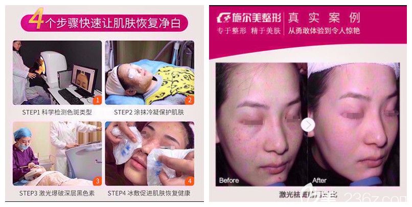 到常州施爾美祛斑對(duì)比蛻變