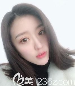 必須得說我被遵義韓美做的這個瘦臉+假體墊下巴后的我迷住了。