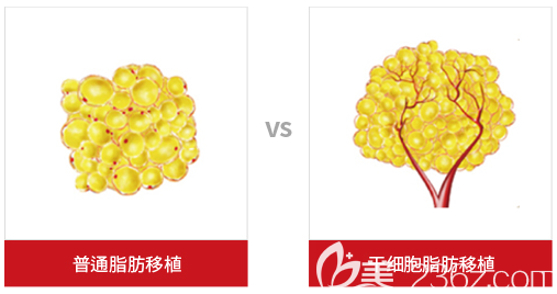 韓國cellpia整形醫(yī)院治療