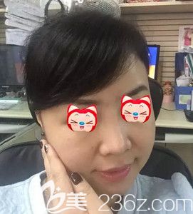 在天宏整形醫(yī)院注射前皮膚暗淡無光 在天宏整形醫(yī)院注射前皮膚暗淡無光