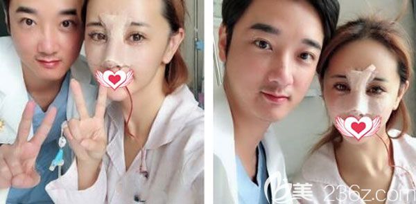 隆鼻失敗修復(fù)第3天沒(méi)有發(fā)現(xiàn)鼻尖紅