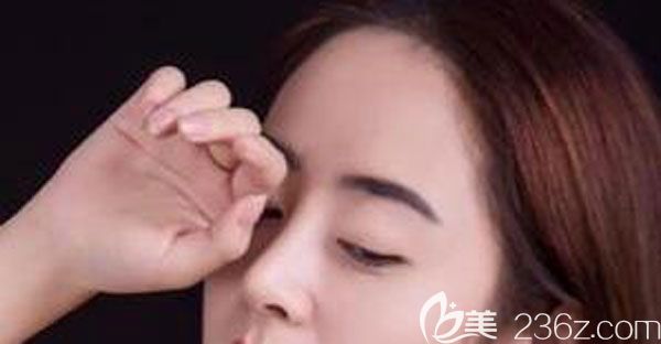 肋軟骨隆鼻+耳軟骨墊鼻尖60天基本已經(jīng)定型 肋軟骨隆鼻+耳軟骨墊鼻尖60天基本已經(jīng)定型