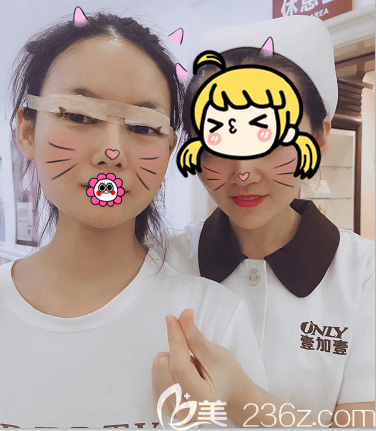 北京壹加壹醫(yī)生給我做雙眼皮修復(fù)+內(nèi)眥矯正+上瞼提肌矯正第三天樣子 北京壹加壹醫(yī)生給我做雙眼皮修復(fù)+內(nèi)眥矯正+上瞼提肌矯正第三天樣子