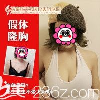 石家莊天宏做假體隆胸案例