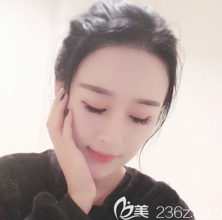 東莞自體脂肪填充哪家醫(yī)院做的好 東莞自體脂肪填充哪家醫(yī)院做的好