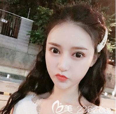 深圳南雅萬(wàn)蕓做雙眼皮技術(shù)怎么樣 深圳南雅萬(wàn)蕓做雙眼皮技術(shù)怎么樣