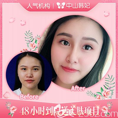 中山韓妃李光琴醫(yī)生雙眼皮手術(shù)<span style= 中山韓妃李光琴醫(yī)生雙眼皮手術(shù)<span style=