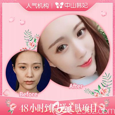 中山韓妃林社彬醫(yī)生玻尿酸全臉填充<span style= 中山韓妃林社彬醫(yī)生玻尿酸全臉填充<span style=