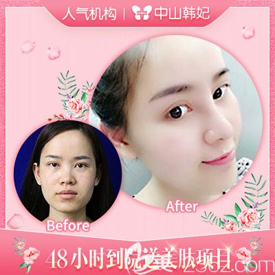 中山韓妃林社彬隆鼻和脂肪填充<span style= 中山韓妃林社彬隆鼻和脂肪填充<span style=