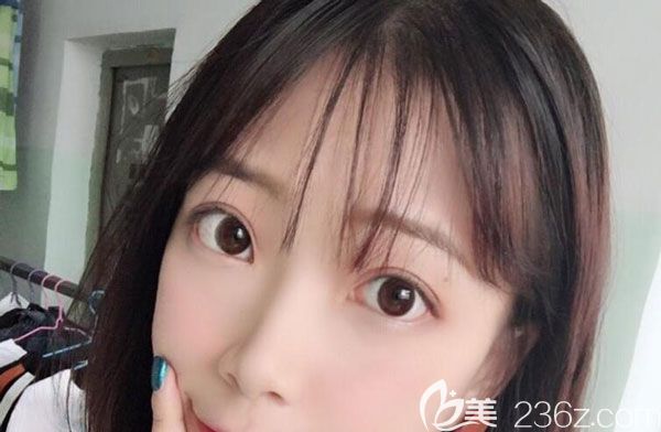 激光祛斑20天皮膚非常清透 激光祛斑20天皮膚非常清透