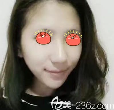 紹興上虞藝美自體脂肪填充<span style= 紹興上虞藝美自體脂肪填充<span style=