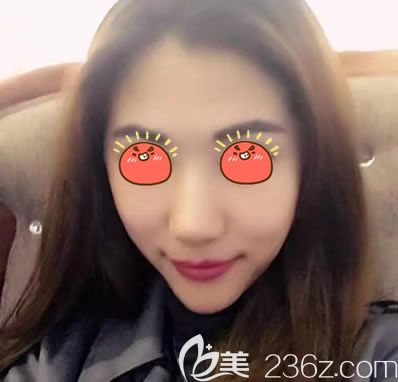 紹興藝美自體脂肪填充<span style= 紹興藝美自體脂肪填充<span style=