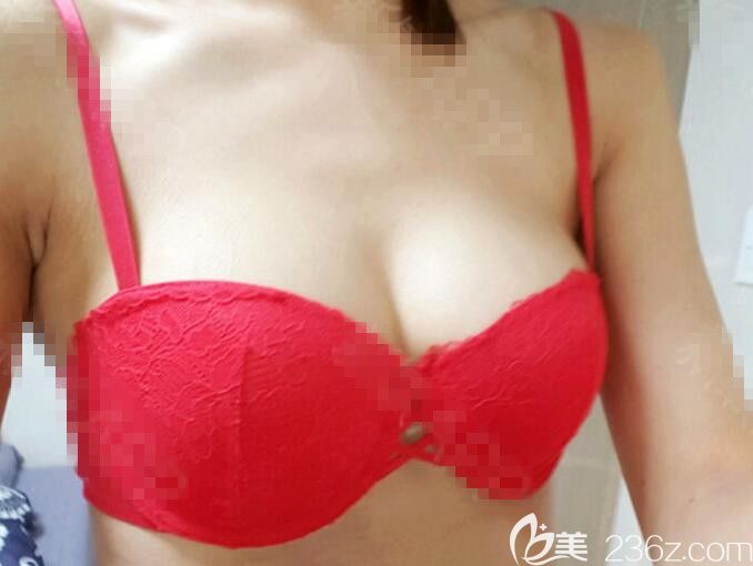 <!--<i data=20240703-sp></i>-->范隆胸怎么樣