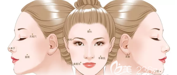 面部自體脂肪移植的部位