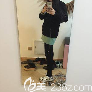 在北京米蘭柏羽麗都注射瘦腿第14天效果 在北京米蘭柏羽麗都注射瘦腿第14天效果