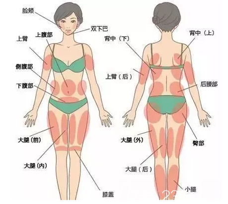 吸脂手術(shù)適合部位 吸脂手術(shù)適合部位