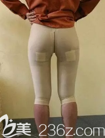 大腿吸脂術(shù)中的樣子 大腿吸脂術(shù)中的樣子