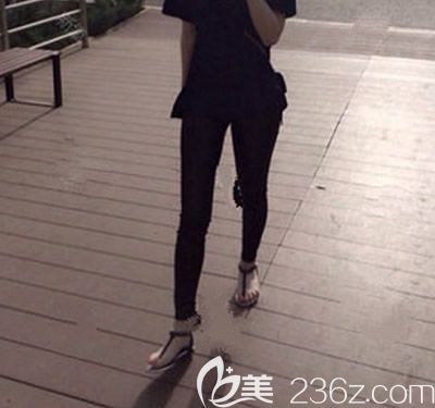 來看我找贛州華美醫(yī)院的牛先翠做大腿環(huán)形吸脂恢復(fù)過程及3個月后的真實效果