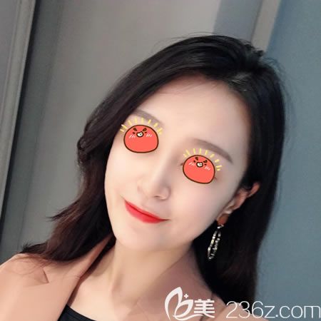 紹興上虞藝美隆鼻<span style= 紹興上虞藝美隆鼻<span style=