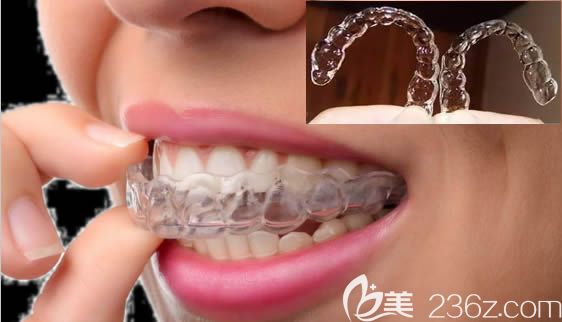 泉州維樂口腔隱形牙套圖