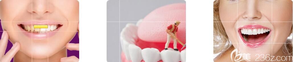 <!--<i data=20240703-sp></i>-->牙齒修復(fù)技術(shù)特點(diǎn) <!--<i data=20240703-sp></i>-->牙齒修復(fù)技術(shù)特點(diǎn)