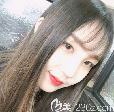 韓式雙眼皮類型那么多別再追求雙眼皮6 7 8毫米效果了，在韓國(guó)樂(lè)于麗顏整形做的眼綜合就很適合自己