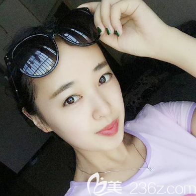 湛江隆鼻哪家好？請看我找湛美陳海濤醫(yī)生做的耳軟骨復(fù)合隆鼻案例效果