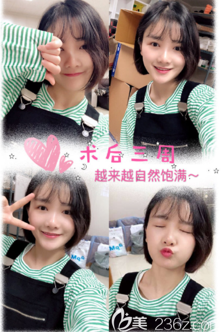 韓國(guó)寶士麗那個(gè)院長(zhǎng)做脂肪移植好 韓國(guó)寶士麗那個(gè)院長(zhǎng)做脂肪移植好