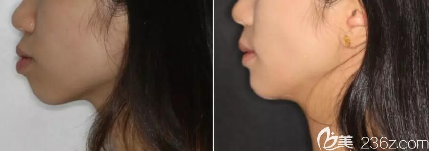 中山好民生口腔何為醫(yī)生的水平怎么樣 中山好民生口腔何為醫(yī)生的水平怎么樣