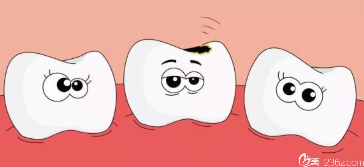 曾燕曉醫(yī)生科普:幼兒齲齒有沒有必要補(bǔ)牙 曾燕曉醫(yī)生科普:幼兒齲齒有沒有必要補(bǔ)牙