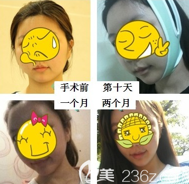 韓國博朗溫金兌奎院長輪廓怎么樣 韓國博朗溫金兌奎院長輪廓怎么樣