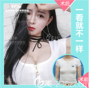 重慶時(shí)光豐胸好不好