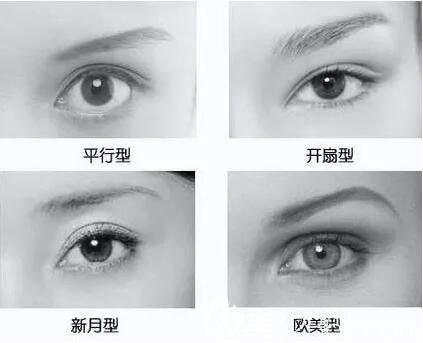 雙眼皮的幾種常見(jiàn)型態(tài)