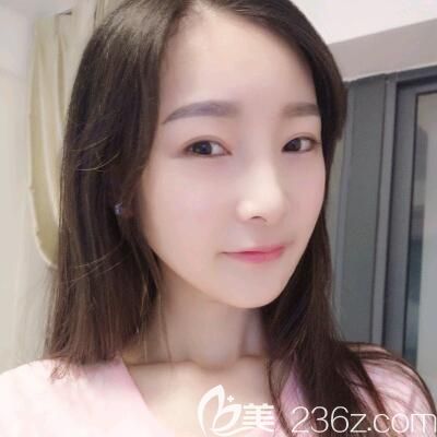 韓國佳輪韓整形醫(yī)院輪廓三件套:下頜角+下巴+顴骨整形手術案例 韓國佳輪韓整形醫(yī)院輪廓三件套:下頜角+下巴+顴骨整形手術案例