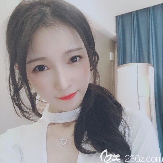 考慮韓國下頜角整形手術(shù)價格與效果成正比,看下我選韓國佳輪韓做的V-LINE瓜子臉好嗎