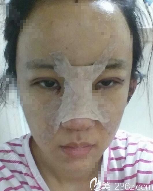 手術(shù)當(dāng)天 手術(shù)當(dāng)天