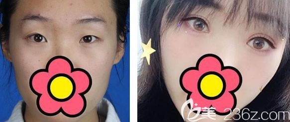 內(nèi)蒙古京美醫(yī)院劉攀龍整形怎么樣 內(nèi)蒙古京美醫(yī)院劉攀龍整形怎么樣