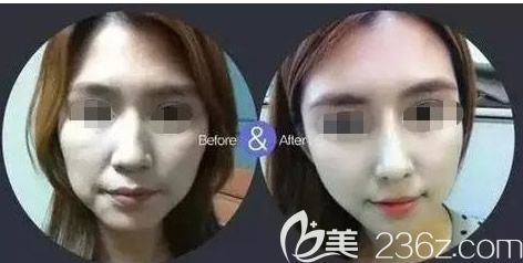 呼和浩特京美徐艦微雕技術(shù)怎么樣 呼和浩特京美徐艦微雕技術(shù)怎么樣