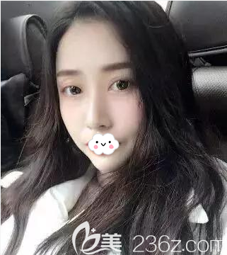 在做了全面部自體脂肪填充手術(shù)后，就連男朋友都夸我減齡很多，少女感十足