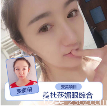 北京藝星美杜莎媚眼綜合案例