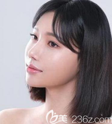 花3W多價格找韓國鼻子修復(fù)口碑好的韓國首爾POP整形醫(yī)院做鼻綜合隆鼻恢復(fù)過程圖