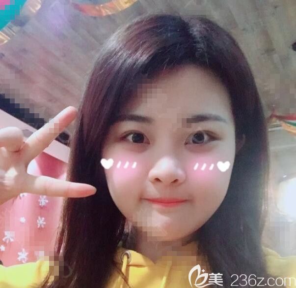 韓國布拉德整形醫(yī)院做輪廓怎么樣