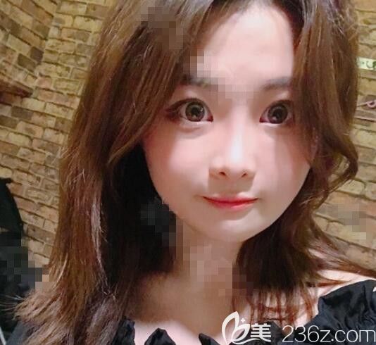 四方臉的我在韓國布拉德整形醫(yī)院邊圣洙做了雙鄂+輪廓艾瑪小臉有點接受不了