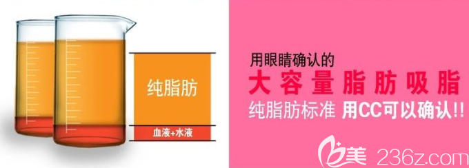 韓國(guó)維摩吸脂手術(shù)