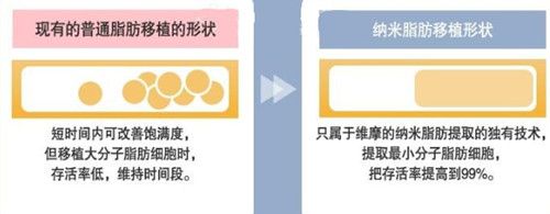 韓國(guó)維摩納米脂肪精雕