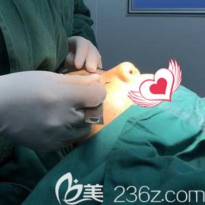 孟祥<!--<i data=20240703-sp></i>-->生為我做綜合鼻整形手術 孟祥<!--<i data=20240703-sp></i>-->生為我做綜合鼻整形手術